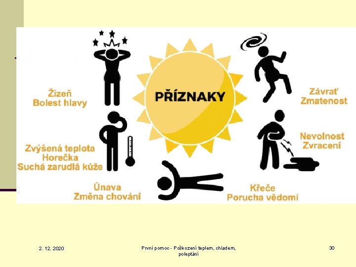 2. 12. 2020 První pomoc - Poškození teplem, chladem, poleptání 30 