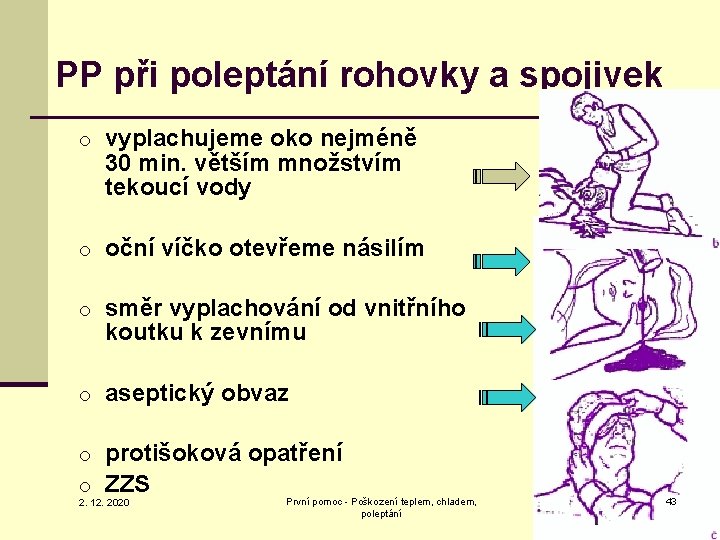 PP při poleptání rohovky a spojivek o vyplachujeme oko nejméně 30 min. větším množstvím