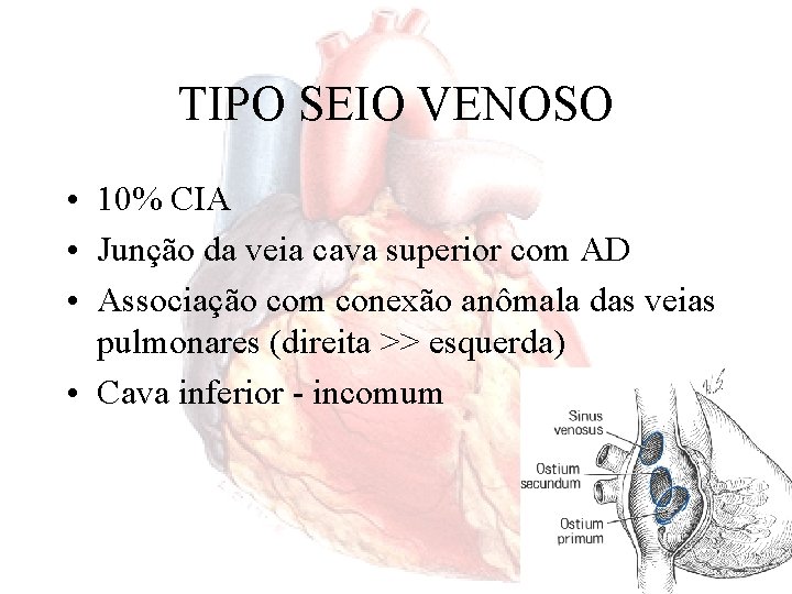 TIPO SEIO VENOSO • 10% CIA • Junção da veia cava superior com AD