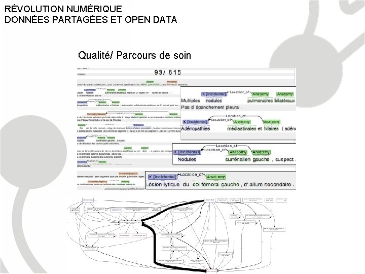 RÉVOLUTION NUMÉRIQUE DONNÉES PARTAGÉES ET OPEN DATA Qualité/ Parcours de soin 