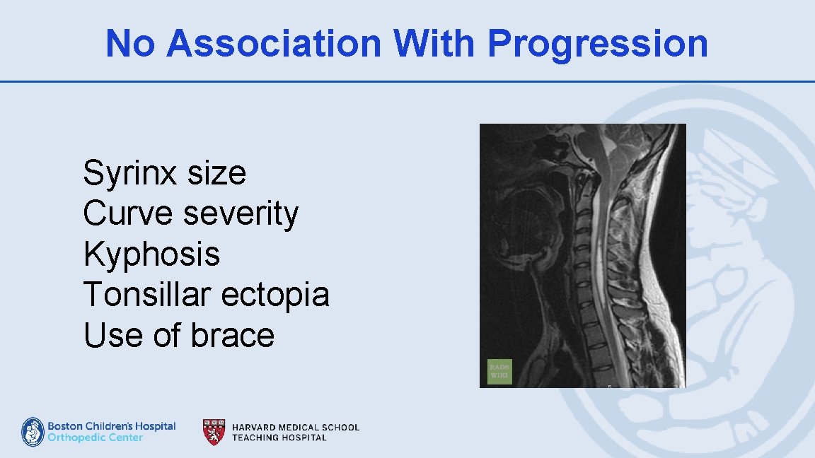 No Association With Progression Syrinx size Curve severity Kyphosis Tonsillar ectopia Use of brace