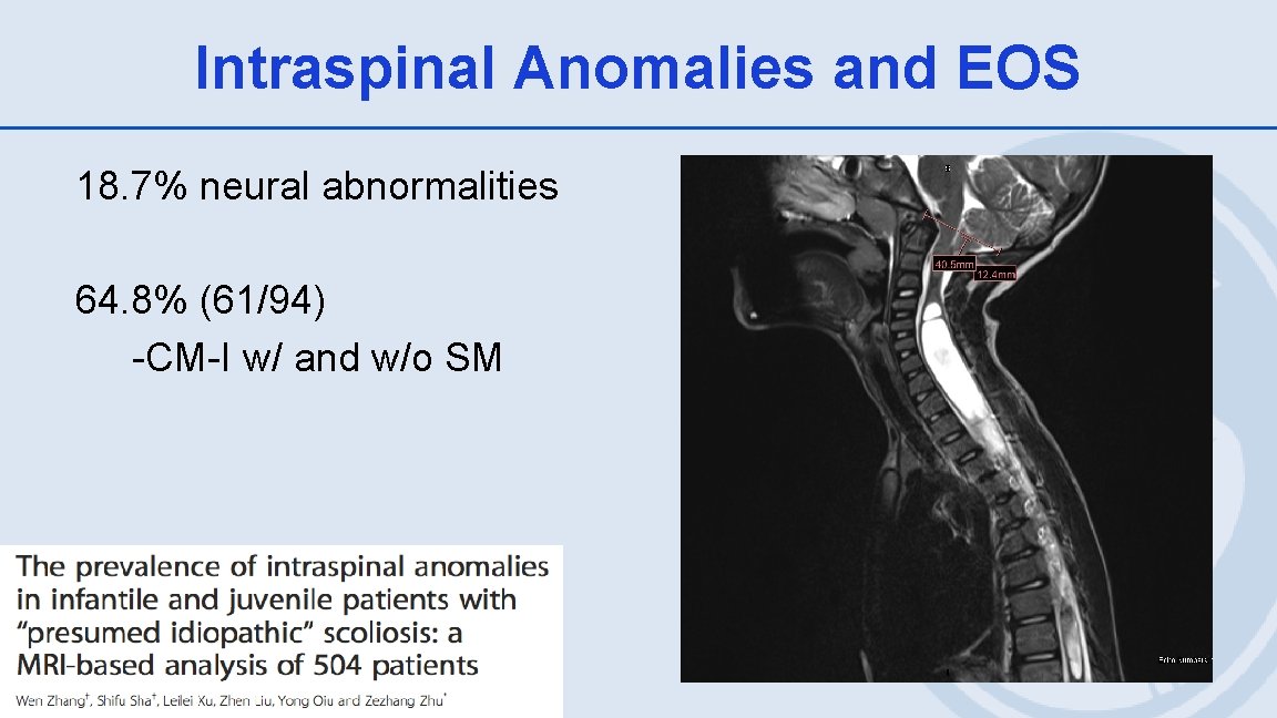 Intraspinal Anomalies and EOS 18. 7% neural abnormalities 64. 8% (61/94) -CM-I w/ and