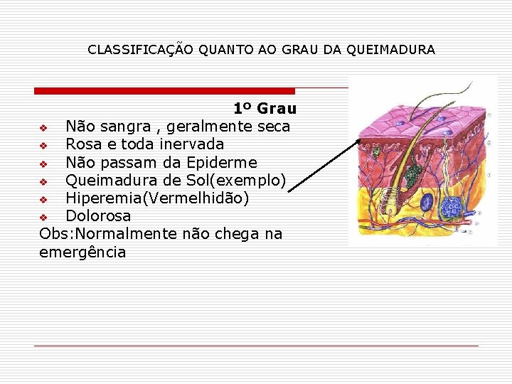 CLASSIFICAÇÃO QUANTO AO GRAU DA QUEIMADURA 1º Grau v Não sangra , geralmente seca