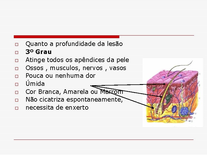 o o o o o Quanto a profundidade da lesão 3º Grau Atinge todos