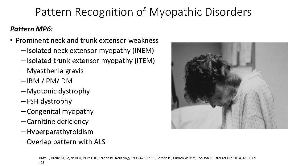 Pattern Recognition of Myopathic Disorders Pattern MP 6: • Prominent neck and trunk extensor