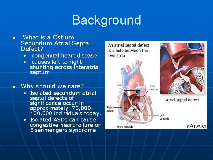 Background n What is a Ostium Secundum Atrial Septal Defect? • congenital heart disease