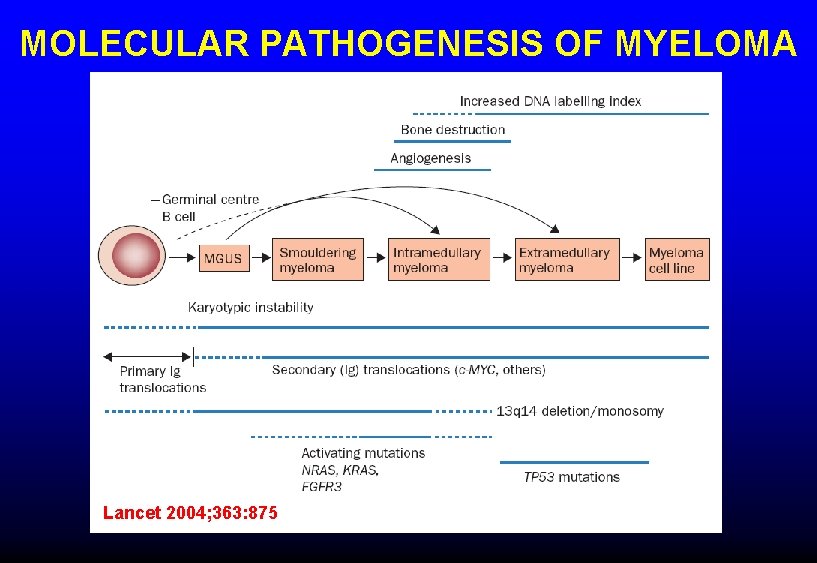 MOLECULAR PATHOGENESIS OF MYELOMA Lancet 2004; 363: 875 