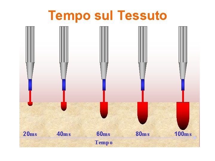 Tempo sul Tessuto 20 ms 40 ms 60 ms Tempo 80 ms 100 ms