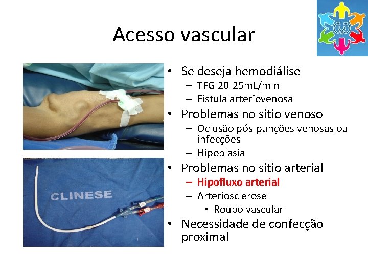 Acesso vascular • Se deseja hemodiálise – TFG 20 -25 m. L/min – Fístula