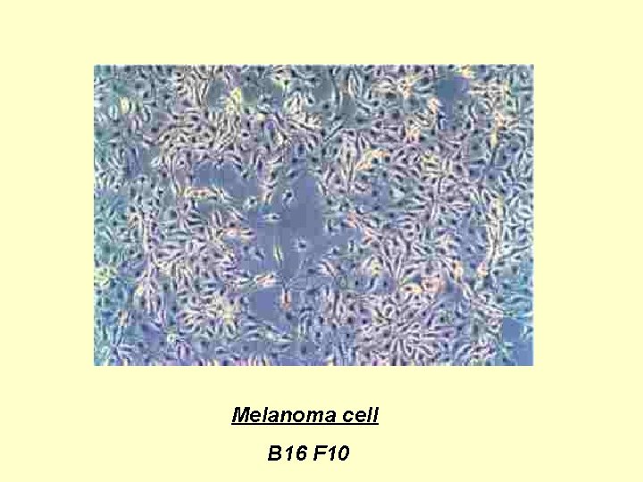Melanoma cell B 16 F 10 Melanoma cell B 16 F 10