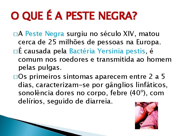 O QUE É A PESTE NEGRA? �A Peste Negra surgiu no século XIV, matou