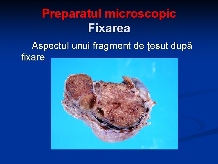 Preparatul microscopic Fixarea Aspectul unui fragment de ţesut după fixare 