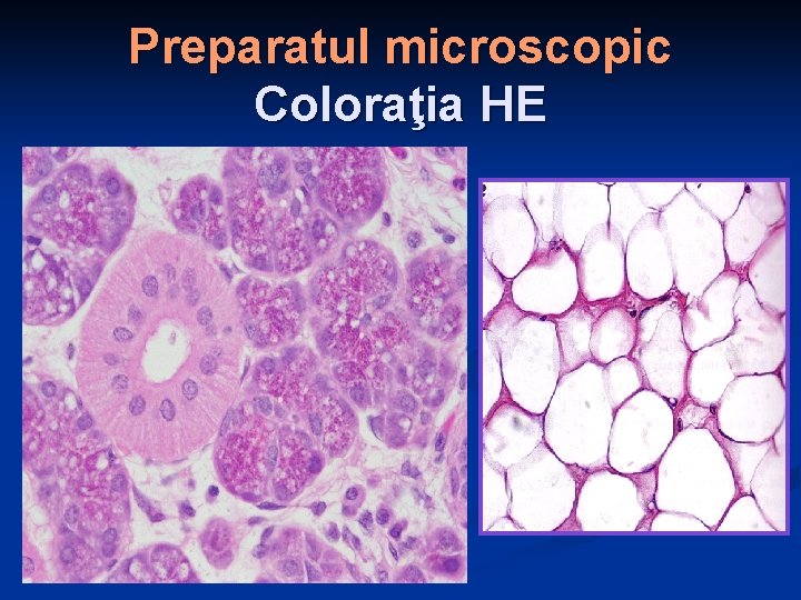 Preparatul microscopic Coloraţia HE 