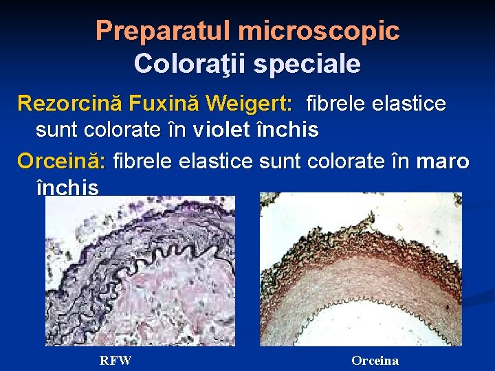 Preparatul microscopic Coloraţii speciale Rezorcină Fuxină Weigert: fibrele elastice sunt colorate în violet închis