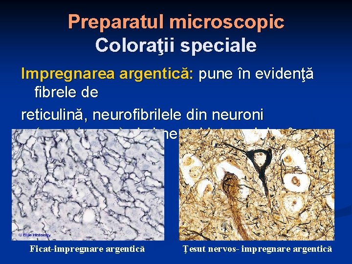 Preparatul microscopic Coloraţii speciale Impregnarea argentică: pune în evidenţă fibrele de reticulină, neurofibrilele din