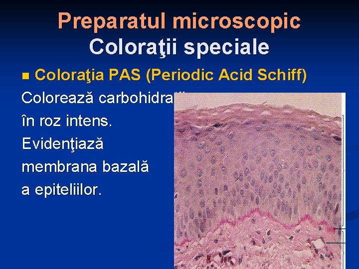 Preparatul microscopic Coloraţii speciale Coloraţia PAS (Periodic Acid Schiff) Colorează carbohidraţii în roz intens.