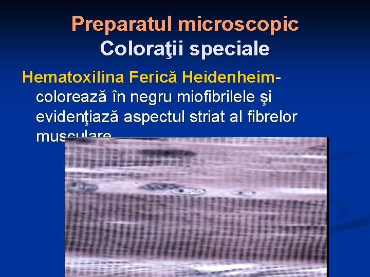 Preparatul microscopic Coloraţii speciale Hematoxilina Ferică Heidenheim- colorează în negru miofibrilele şi evidenţiază aspectul