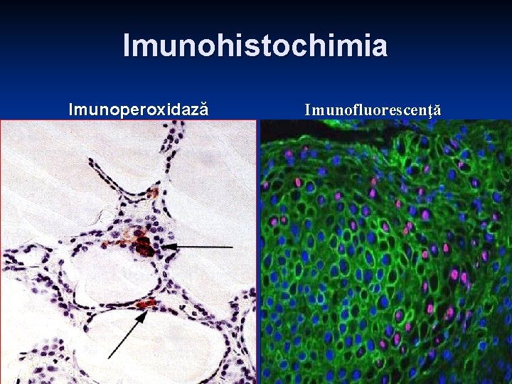 Imunohistochimia Imunoperoxidază Imunofluorescenţă 