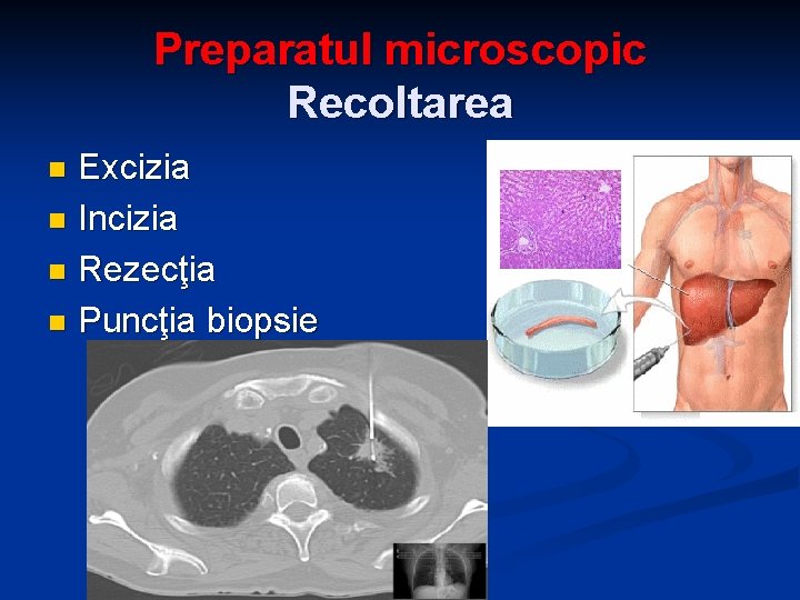 Preparatul microscopic Recoltarea Excizia n Incizia n Rezecţia n Puncţia biopsie n 