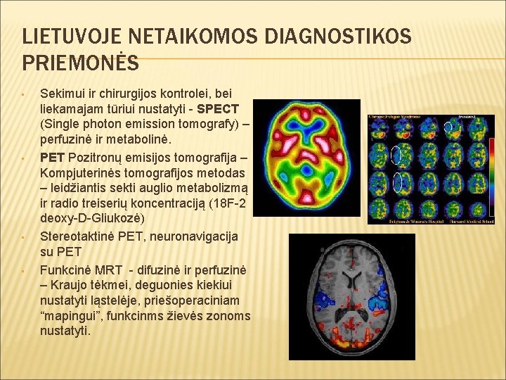 LIETUVOJE NETAIKOMOS DIAGNOSTIKOS PRIEMONĖS • • Sekimui ir chirurgijos kontrolei, bei liekamajam tūriui nustatyti
