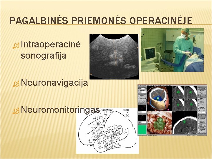 PAGALBINĖS PRIEMONĖS OPERACINĖJE Intraoperacinė sonografija Neuronavigacija Neuromonitoringas 