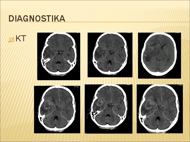 DIAGNOSTIKA KT 