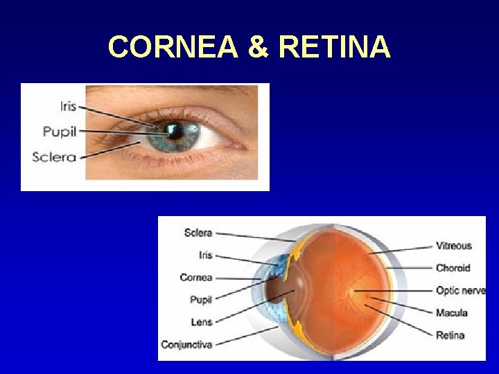 CORNEA & RETINA 