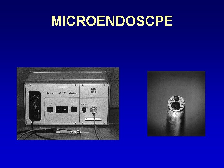 MICROENDOSCPE 