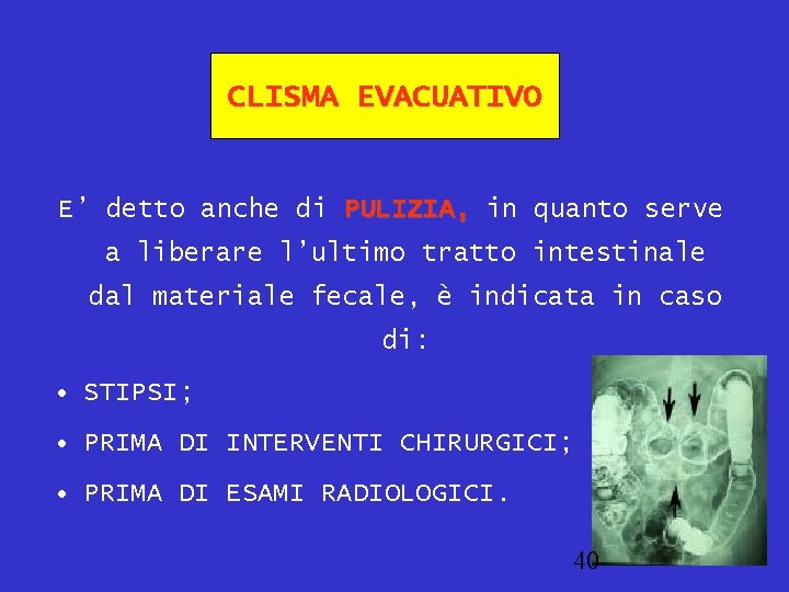 CLISMA EVACUATIVO E’ detto anche di PULIZIA, in quanto serve a liberare l’ultimo tratto