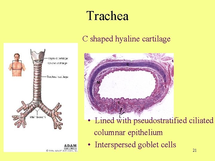 Trachea C shaped hyaline cartilage • Lined with pseudostratified ciliated columnar epithelium • Interspersed