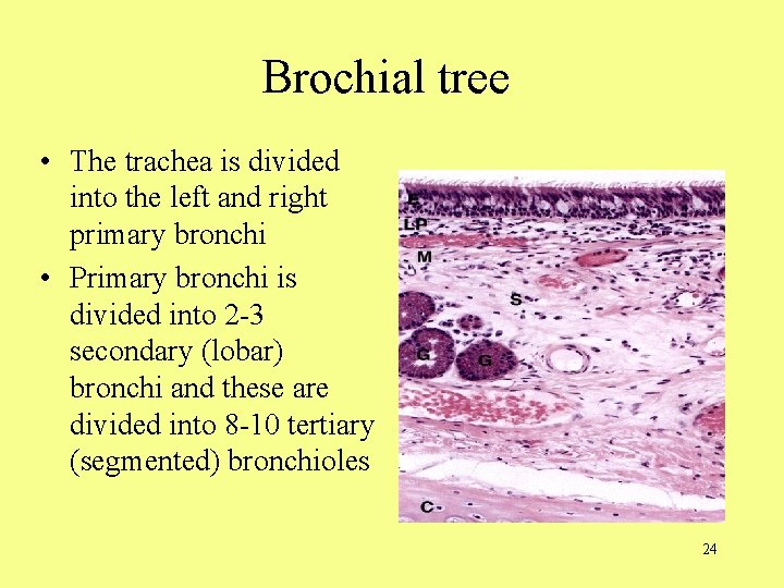 Brochial tree • The trachea is divided into the left and right primary bronchi