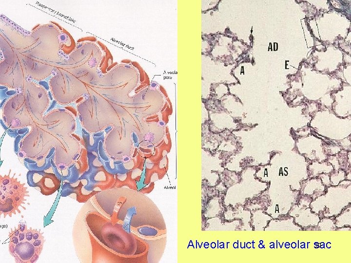 29 Alveolar duct & alveolar sac 