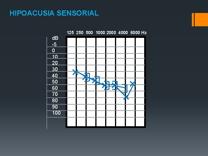 HIPOACUSIA SENSORIAL 125 250 500 1000 2000 4000 8000 Hz d. B -5 0 HIPOACUSIA SENSORIAL 125 250 500 1000 2000 4000 8000 Hz d. B -5 0