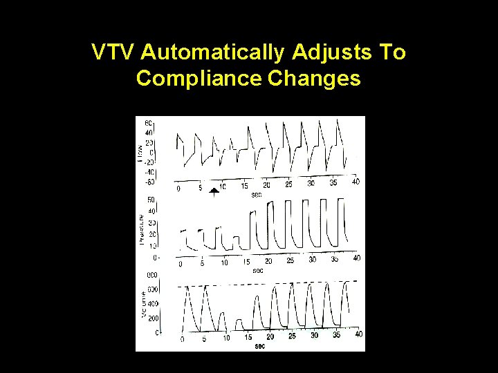 VTV Automatically Adjusts To Compliance Changes 