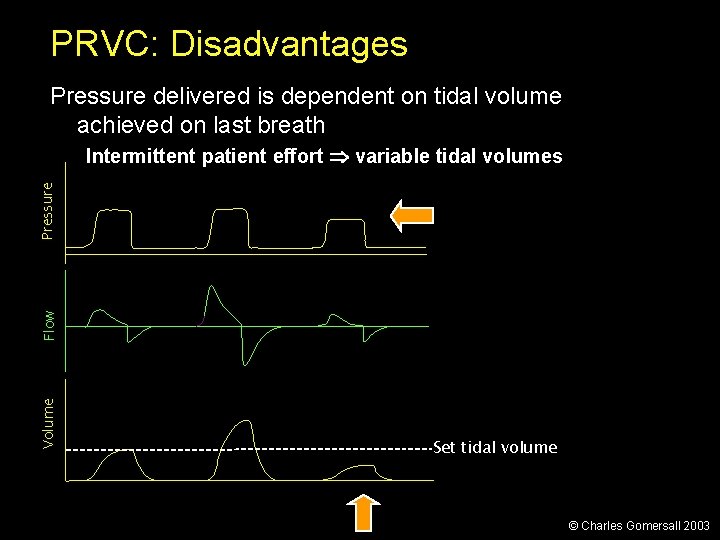 PRVC: Disadvantages Pressure delivered is dependent on tidal volume achieved on last breath Volume