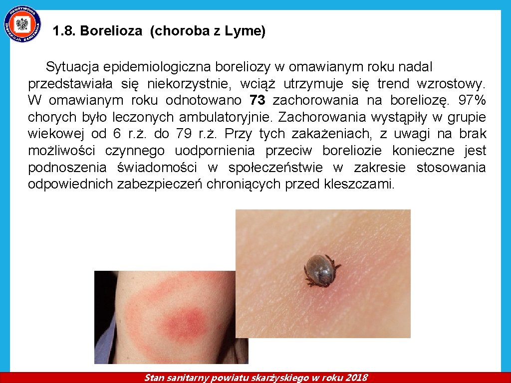 1. 8. Borelioza (choroba z Lyme) Sytuacja epidemiologiczna boreliozy w omawianym roku nadal przedstawiała