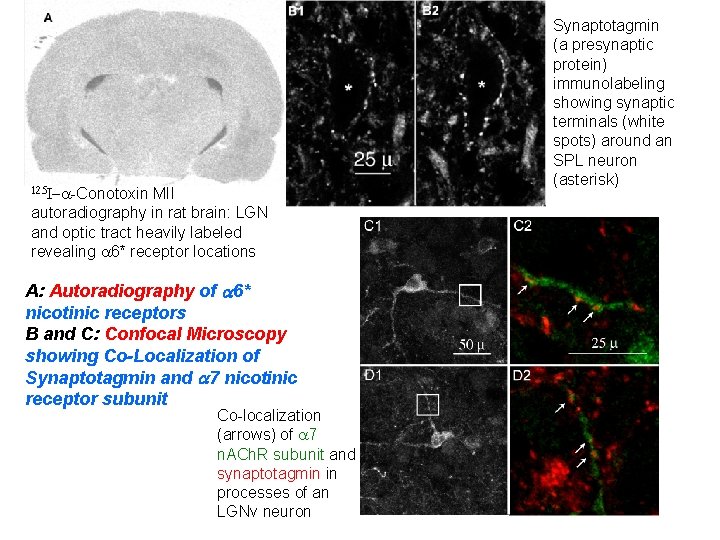 125 I-a-Conotoxin MII autoradiography in rat brain: LGN and optic tract heavily labeled revealing