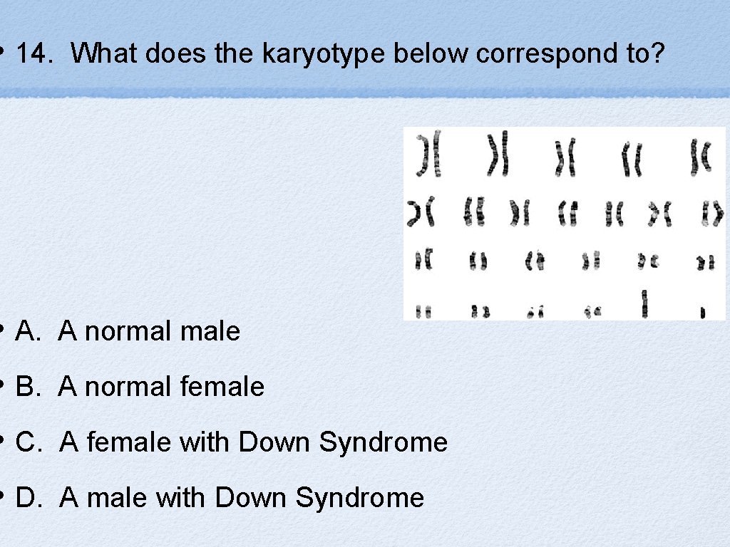  • 14. What does the karyotype below correspond to? • A. A normal