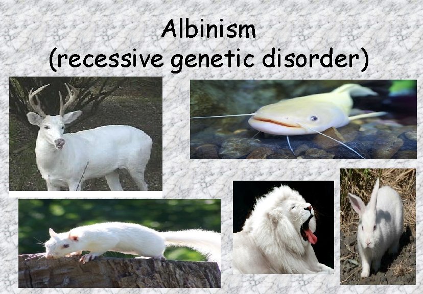 Albinism (recessive genetic disorder) 