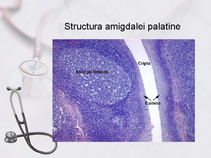 Structura amigdalei palatine 