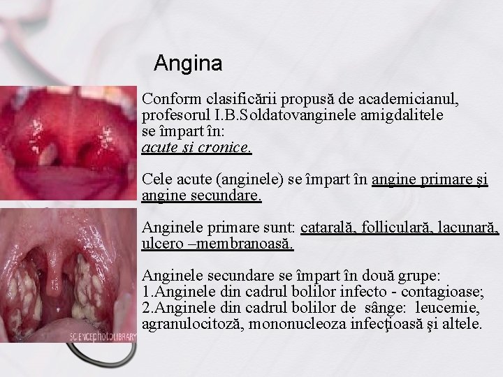 Angina Conform clasificării propusă de academicianul, profesorul I. B. Soldatovanginele amigdalitele se împart în: