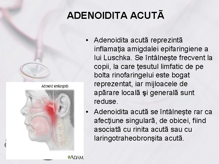 ADENOIDITA ACUTÃ • Adenoidita acutã reprezintã inflamaţia amigdalei epifaringiene a lui Luschka. Se întâlneşte