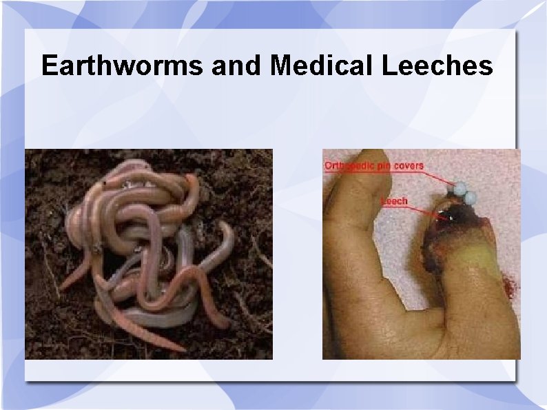 Earthworms and Medical Leeches 