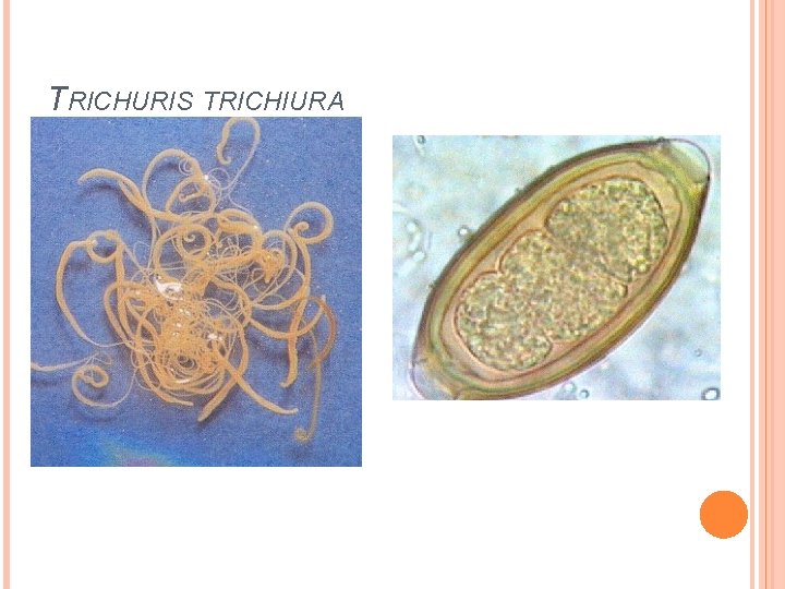 TRICHURIS TRICHIURA 