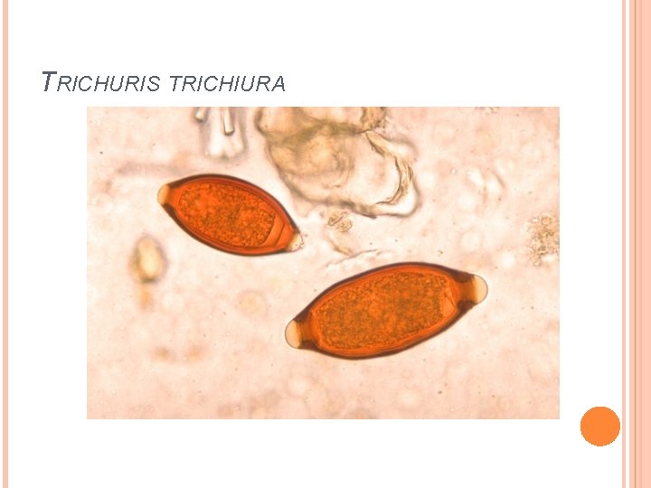 TRICHURIS TRICHIURA 