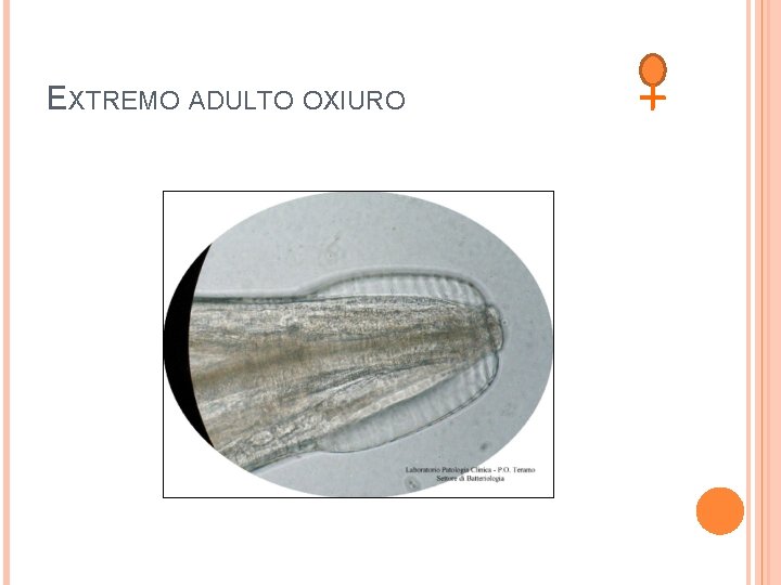 EXTREMO ADULTO OXIURO 