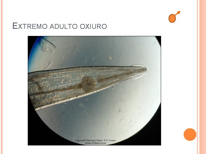 EXTREMO ADULTO OXIURO 