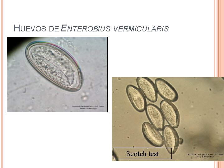 HUEVOS DE ENTEROBIUS VERMICULARIS Scotch test 