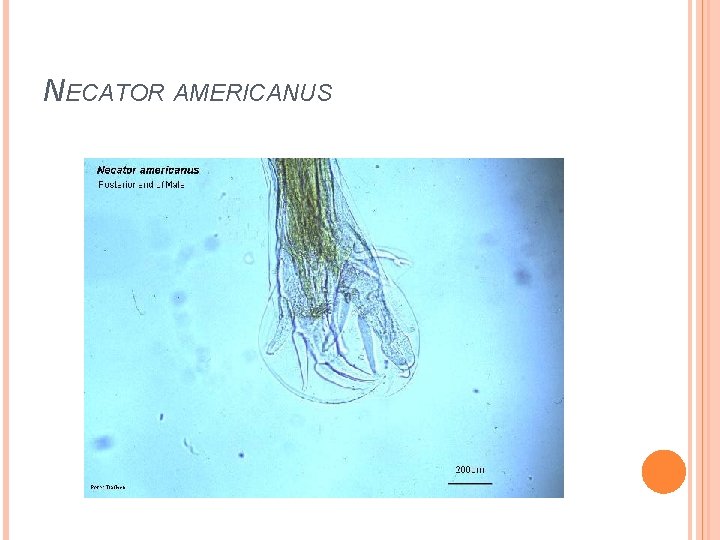 NECATOR AMERICANUS 