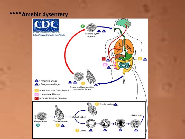 ****Amebic dysentery 